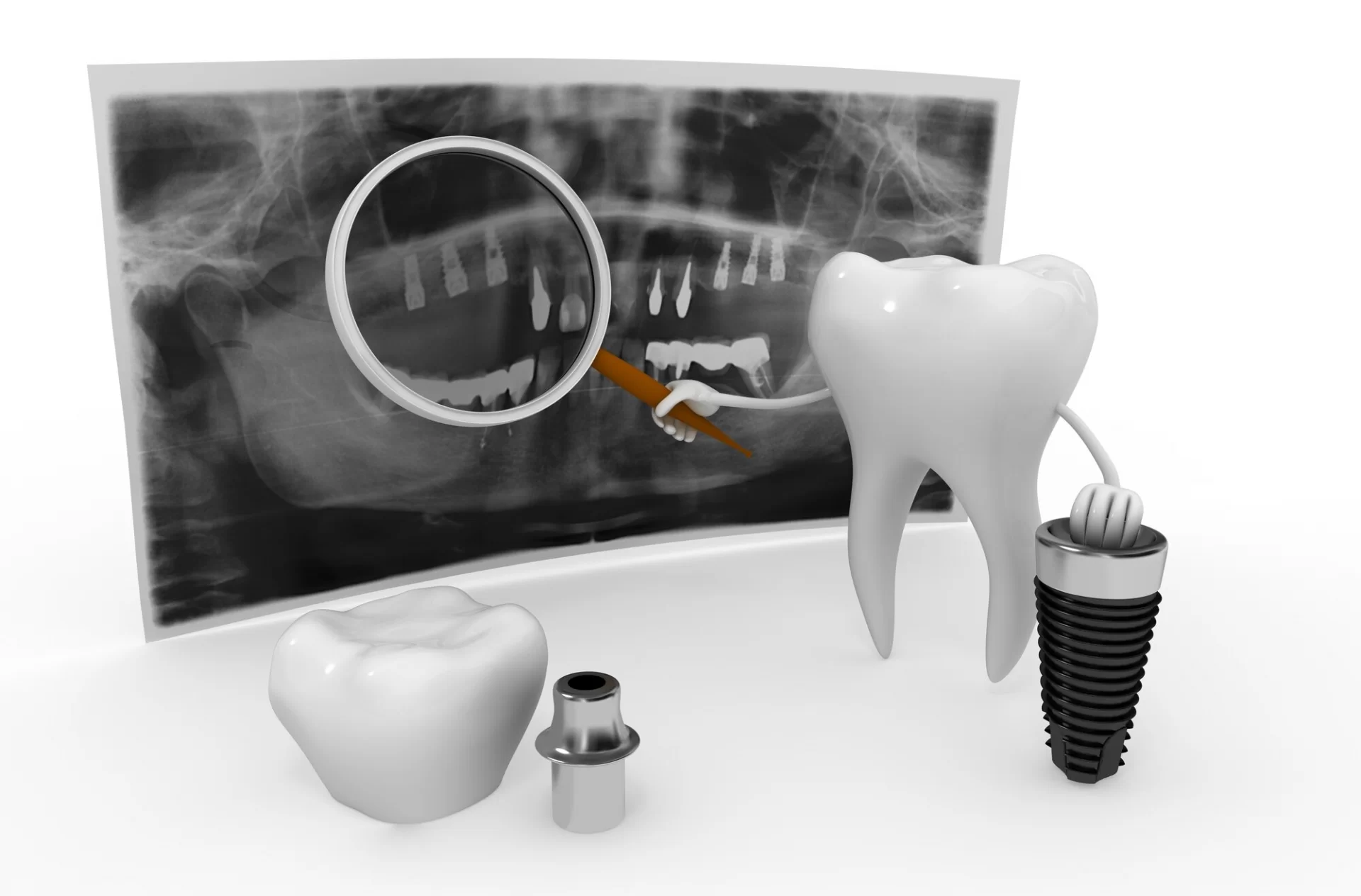 Implantologie in Neu-Ulm