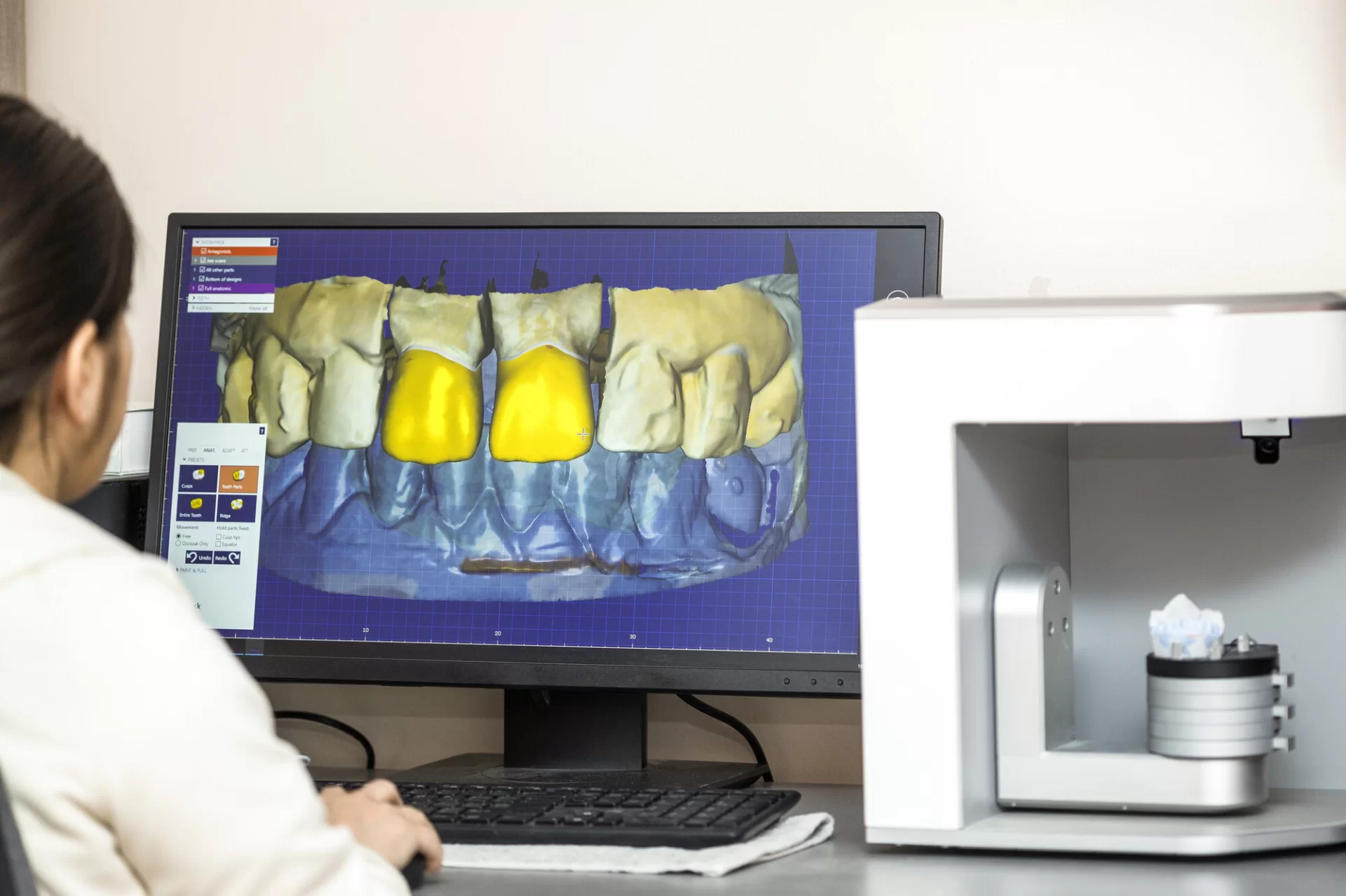 Digitale Planung von Zahnersatz mit CAD/CAM-Technologie
